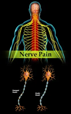 Nerve Pain android App screenshot 5